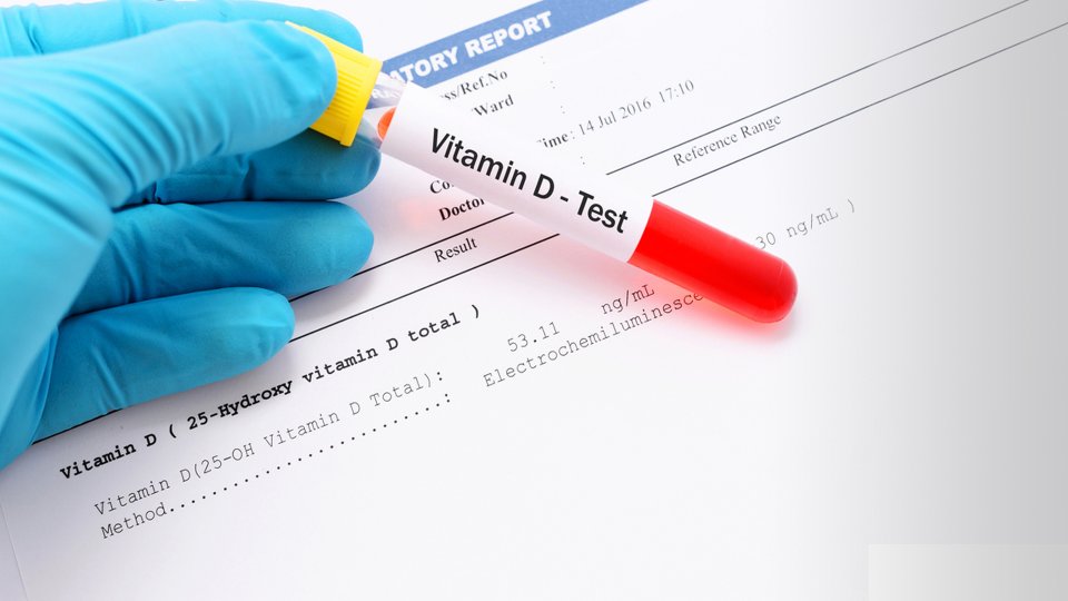 D Vitamini Testi Nedir? Nasıl Yapılır?