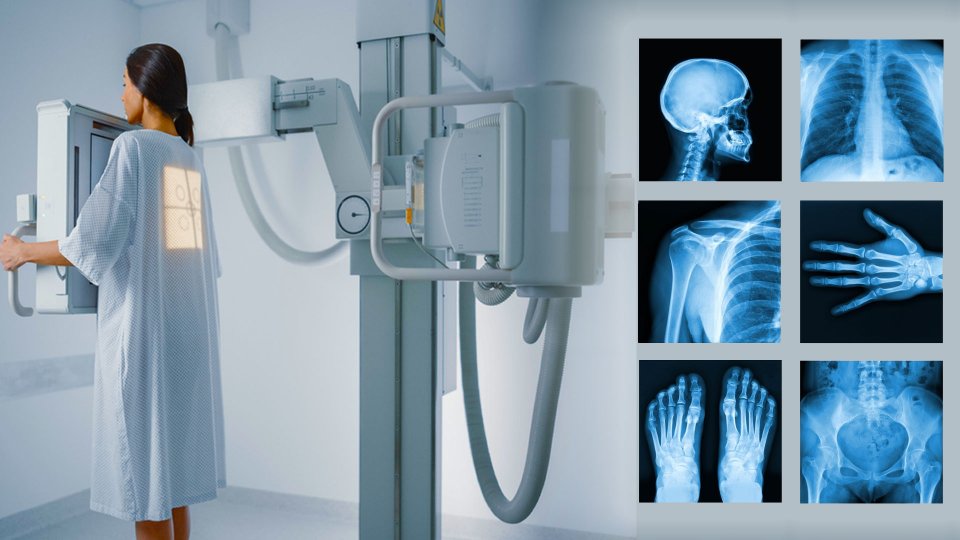 Röntgen Nedir? - Büyük Anadolu Hastanesi