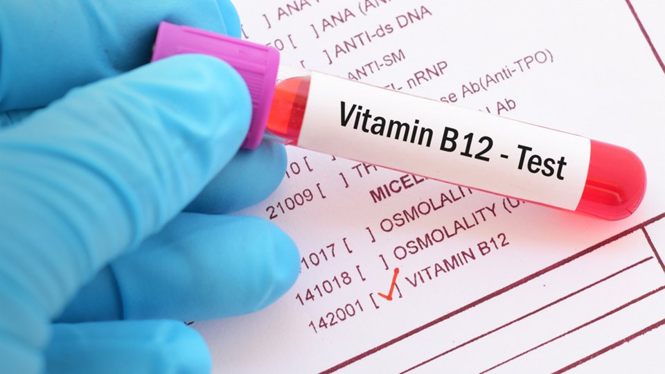 B12 Vitamini Testi Nedir? Nasıl Yapılır?